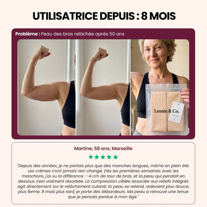 Avis de Martine, 58 ans, Marseille, après huit mois avec les manchons sculptants 3D