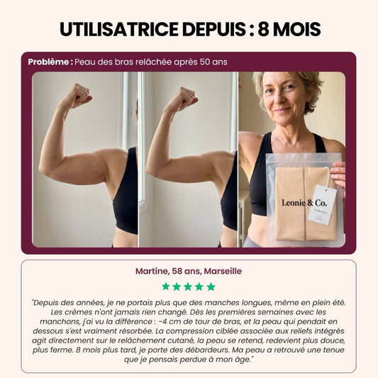 Avis de Martine, 58 ans, Marseille, après huit mois avec les manchons sculptants 3D